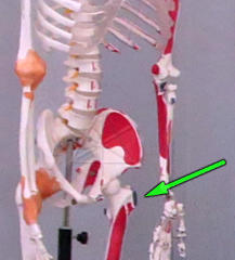 Greater trochanter location on skeleton
